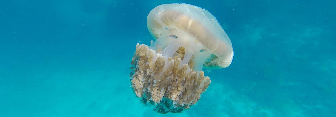 How to treat a jellyfish sting naturally ?